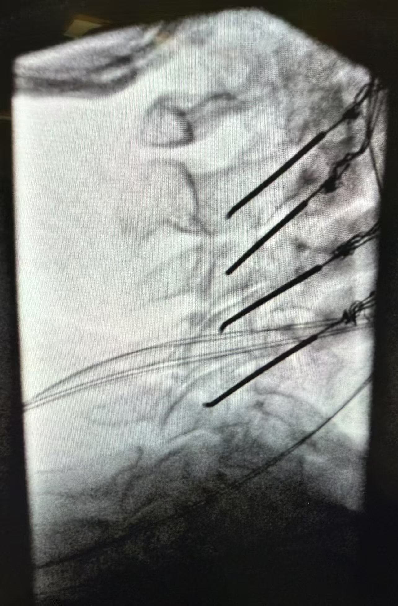Clinical case example 3
