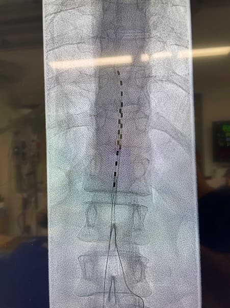 Clinical case example 4